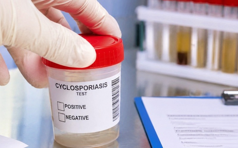 1784115963-preocupacion-aumento-casos-ciclosporiasis-estados-unidos-8cfc75.jpg