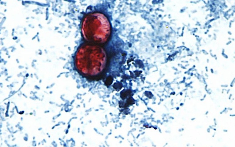 1vpjfrx2cb_0x1000__detail-7f499b.jpg