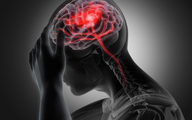 accidente-cerebrovascular-0d6bfc.jpg