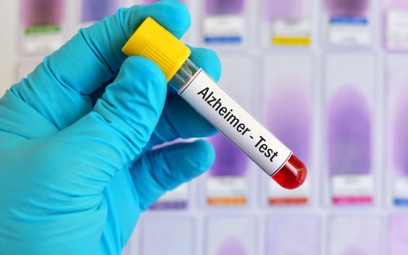 alzheimer-prueba-de-sangre-937414952-557e82.jpg