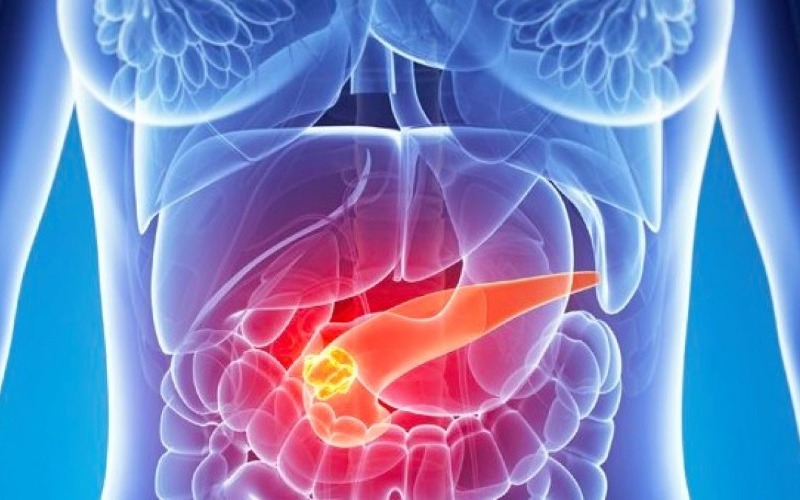 cancer-de-pancreas-tratamiento-1280x720-8b16f8.jpg