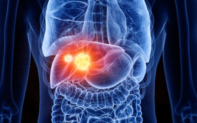 cancer-higado-3d.jpg-5adb9e.png