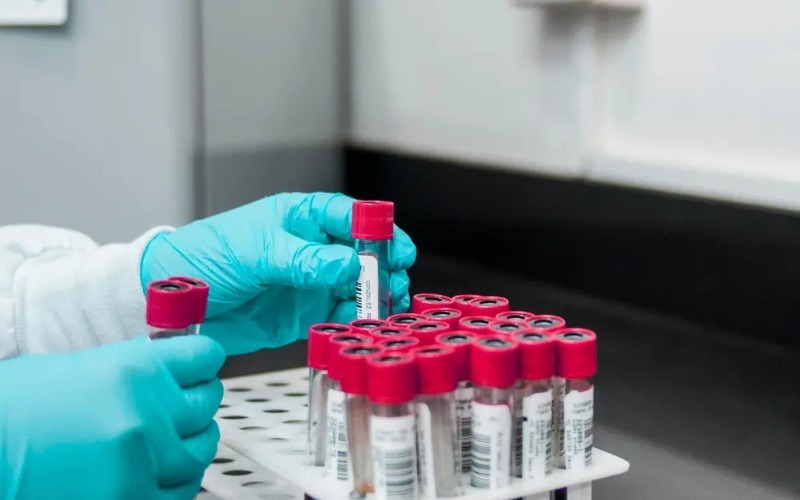 cancer-prueba-sangre-diagnostico-temprano_48457423_20250801072813-23bc2e.jpg