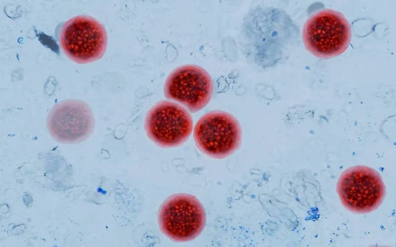 ciclosporiasis-utah-casos-e9bd03.jpg
