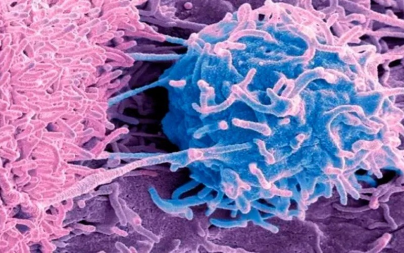 descubren-un-mecanismo-bacteriano-que-podria-destruir-celulas-tumorales-09-de-oct-elorientaldemonagas.com_-1024x477-551748.jpg
