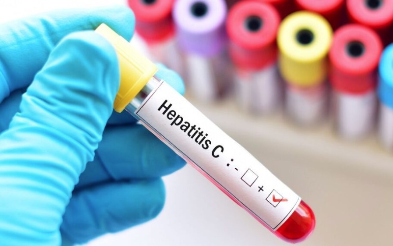 el-80-de-las-personas-con-hepatitis-c-todavia-no-recibio-tratamiento-segun-la-oms-037fd9.jpg