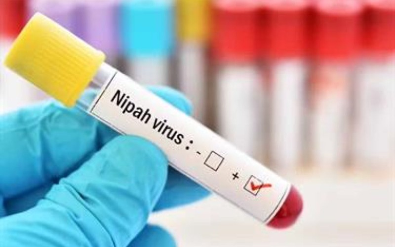 nipah-virus-6e88a4a4-focus-min0.28-min0.08-375-240-91f29a.jpg